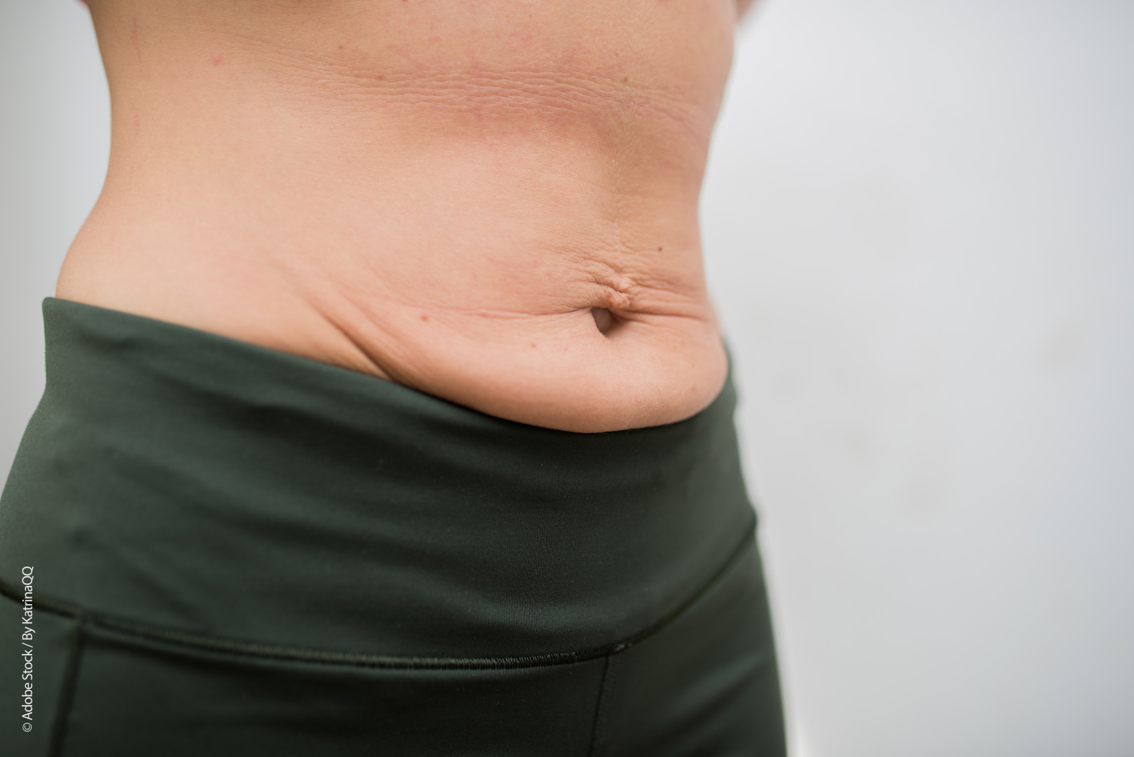 skinlweightloss